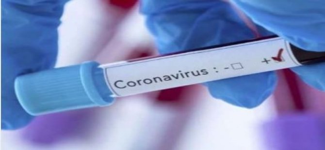 Çankırı’ya düğüne gittiler koronavirüs kaptılar
